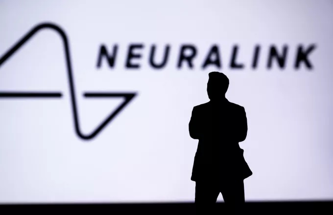 Η Neuralink του Ίλον Μασκ παραδέχθηκε δυσλειτουργία στο εμφύτευμα εγκεφάλου που τοποθέτησε σε ασθενή